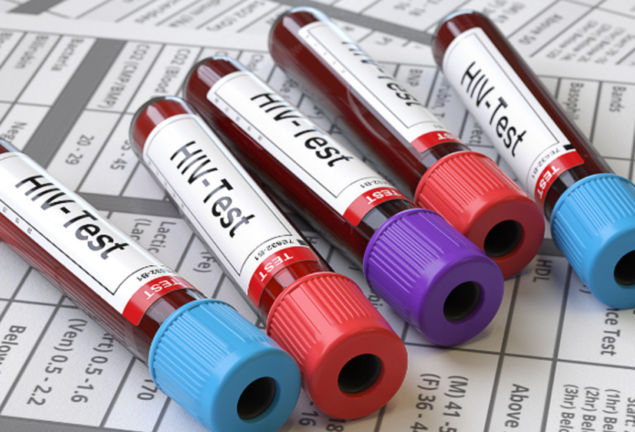 552 cases of Human Immunodeficiency Virus (HIV) reported this year